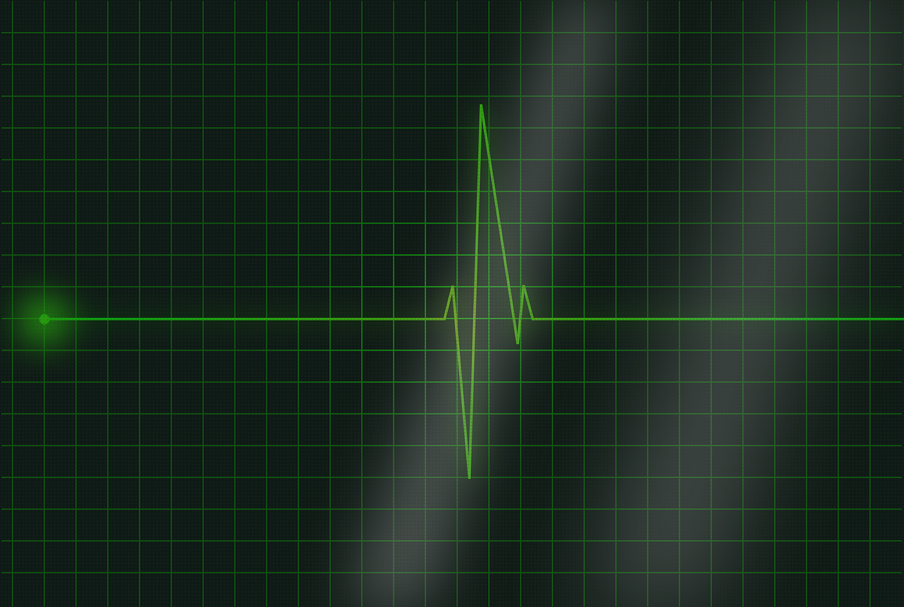 Los 17 Mejores electrocardiograma inalámbricos bajo análisis